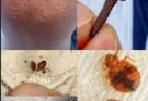 ⚠️ BE CAREFUL, If you spot these dots on your skin, it means you have Ca…See more